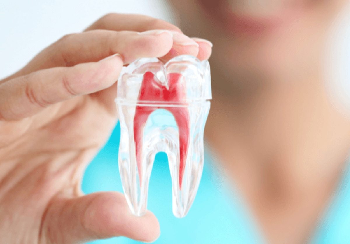 Modelo de diente con conductos radiculares usado en endodoncia en Clínica Smiles