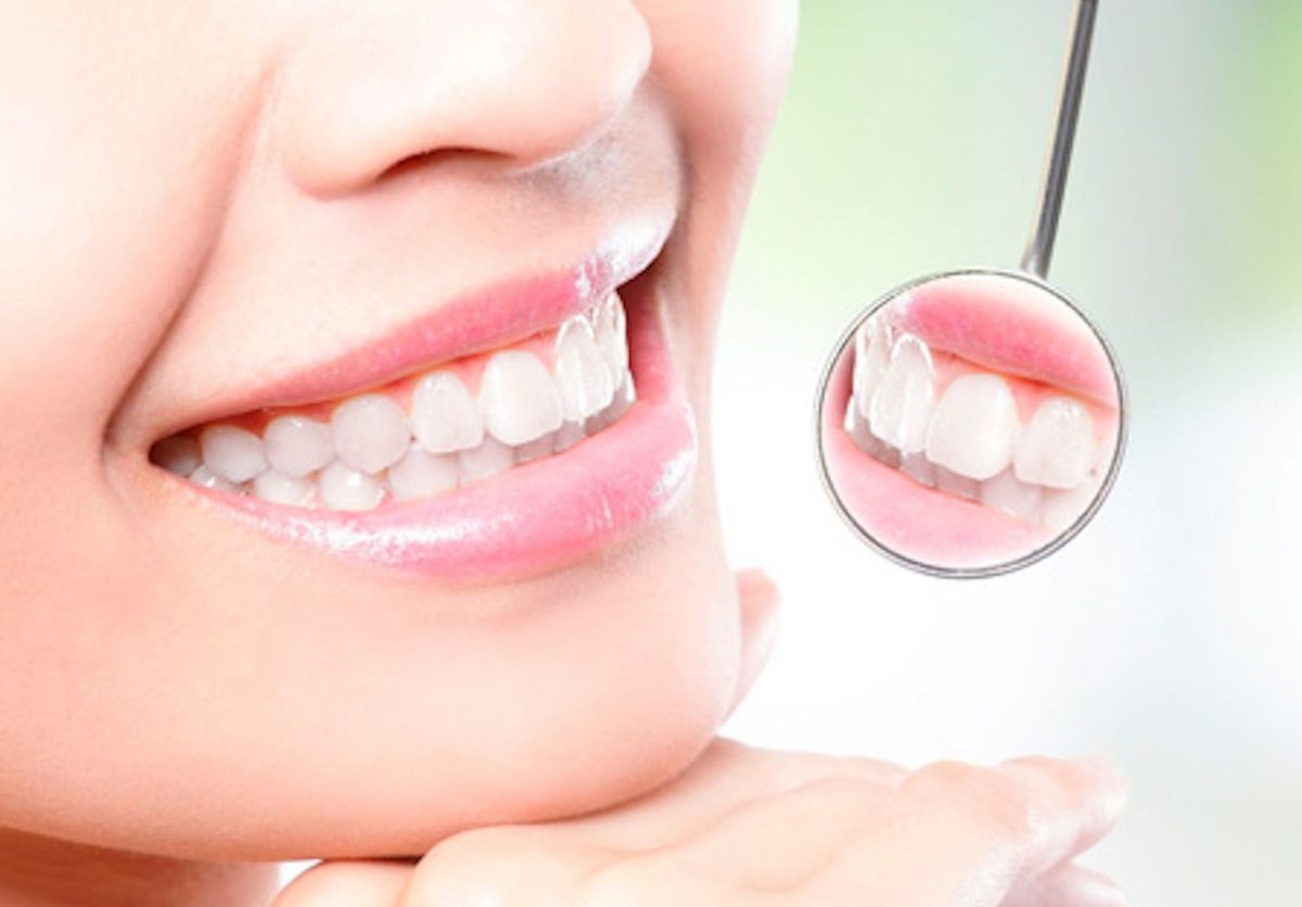 Sonrisa tras un tratamiento de odontología estética en Clínica Smiles Cali