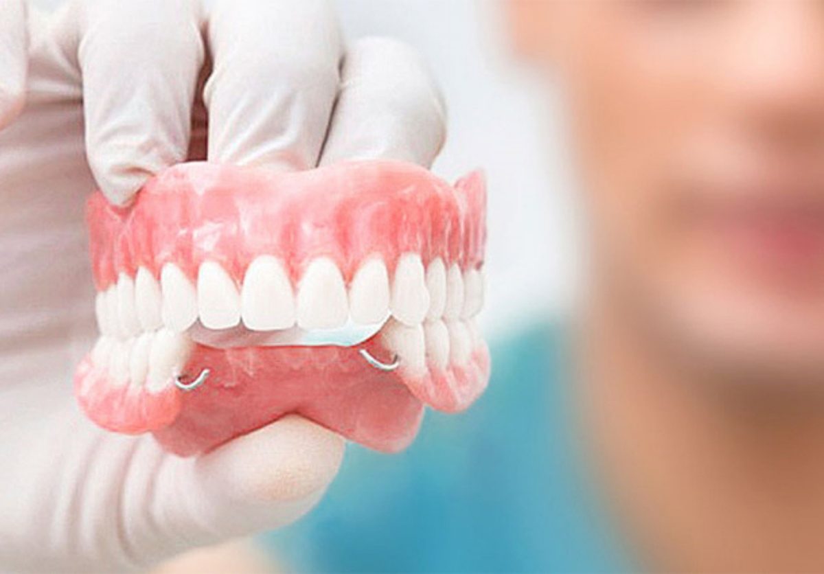 Especialista sosteniendo una prótesis dental en Clínica Smiles Cali